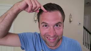 Hair pomade is one of the most versatile of all hair styling products for men. Hair Loss Applying Pomade To Dry Hair Youtube