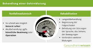 Hirnblutungen Ursachen Symptome Diagnose Behandlung