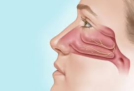 Image result for Sinus Surgery