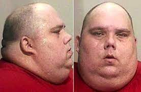 Man Chokes On Nail Clipper Removing Popcorn Kernel From Throat Theintellectualbro