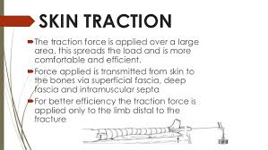Traction Orthopedics