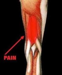 Image result for Hamstring Strain