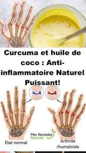 Curcuma Et Huile De Coco Anti Inflammatoire Naturel Puissant Health Healthy Family Meals Health Fitness