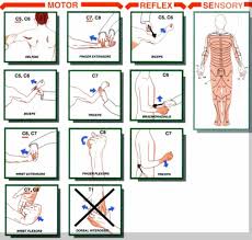 Anatomic Basis Of Neurologic Diagnosis Occupational Therapy Pediatric Physical Therapy Physical Therapy