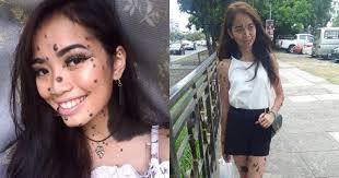 Jadi, di sini dikongsikan beberapa cara untuk hilangkan 'tahi lalat' pada pakaian serta beberapa fabrik lain yang boleh anda lakukan di rumah. Betulkah Petua Buang Tahi Lalat Ini Berkesan Tanpa Pembedahan Syafierayamin Com Beauty Blogger Malaysia