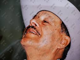 Hola grupo algunas personas por ahí siguen comentando sobre Antonio pedro  ,que porque el no tenia cicatrices ni su barba partida , bueno sin decir  más con esta foto que ya anteriormente