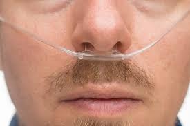 The cannulas on this page all have straight prongs and are available in various lengths. Do You Use A Smaller Cannula For Your Oxygen Pulmonary Hypertension News Forums