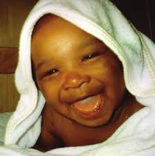 Topical Fluoride Recommendations for High-Risk Children