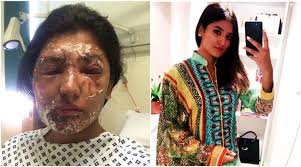 This acid attack survivor's incredible post-recovery photos are every bit  inspiring