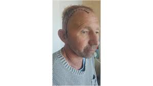 Help "Whitty" Recover