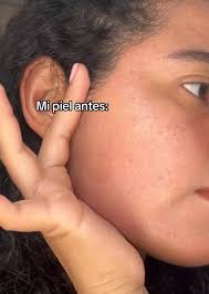 Lo que más me gusta de Effaclar AZ es que se absorbe rápido y es ideal...