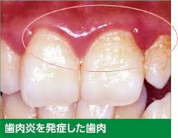 ADVICE07 | 歯みがきマイスター