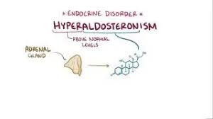 Image result for Hyperaldosteronism