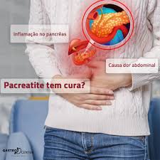 Scopri la diagnosi e la dieta da seguire. Pancreatite Blog Rede Gastrocenter Belo Horizonte