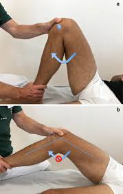Image result for Patella Mobility Test