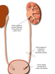 Pin On Health