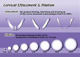Pic Diagram Of Dilation And Cervical Effecement Dilation And Effacement Cervix Cervical Dilation Chart