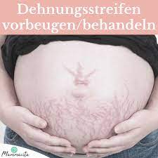 Schwangerschaftsstreifen Was Hilft Wirklich Mammacita