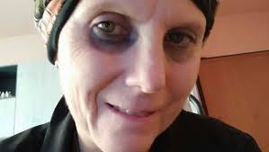 Daniela Molinari, la battaglia infinita dell'infermiera malata di cancro:  "Ora cerco il mio padre biologico. Sono stremata, mi aiuti"