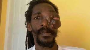 Fundraiser by Kim Bruce : Help Christopher Beat Cancer