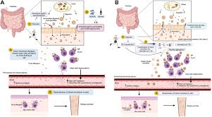 Image result for Exercise-Induced Anaphylaxis