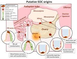 These are malignant tumors that form from cells on the surface of the ovary. Cancers Free Full Text Complex Determinants Of Epithelial Mesenchymal Phenotypic Plasticity In Ovarian Cancer