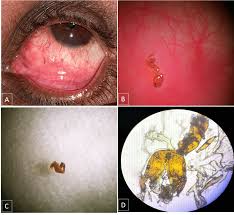 Image result for ant bite