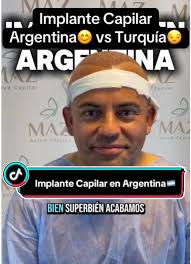 Implante Capilar: La Experiencia de un Paciente Chileno