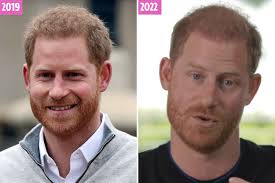 Prince Harry shocks fans with new shaved haircut as he admits he 'burns the  candle at both ends' & 'experiences burnout'