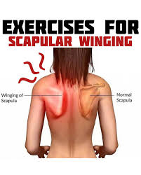 Image result for Winged Scapula