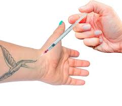 Information regarding the tattoo removal process. Tattoo Removal Surgery