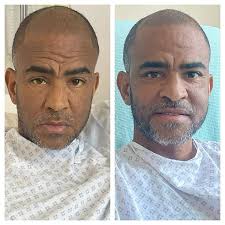 EXCLUSIVE: Ill, thin and broken, ex-England footballer Kieron Dyer, 44, was  dying with a rare liver disease just 11 weeks ago. Now, he speaks for the  first time after a 'miracle' transplant
