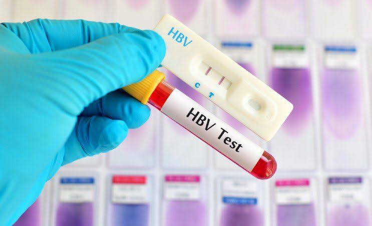 HBSAG HCV HIV I-II product image