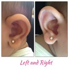 Uneven Ear Piercing Babycenter