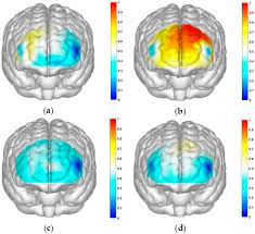 Exploring the Impact of Smartphone Addiction on Risk Decision-Making  Behavior among College Students Based on fNIRS Technology