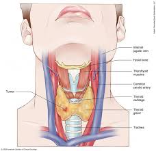 A sore throat or difficulty swallowing that doesn't get better. Thyroid Cancer Stages Cancer Net
