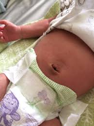 Researchers now say this might kill bacteria. Bathing A Newborn With Umbilical Cord Off 51