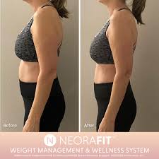We did not find results for: Neora On Twitter Accountability Helps Us Stay Motivated And Avoid Making Excuses Follow This Link Https T Co 9bmxowbgln To Join The Neora Getfitchallenge For The Chance To Win Amazing Prizes Like A Peloton