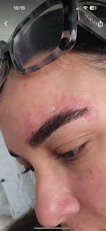 I am allergic to mango and I see that the bronzing lotion has mango  butter😭😭 I've never used mango butter before. do you think it wouldn't be  an issue or should I