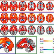 Wah banyak sekali drama natalnya. 45223 Pdfs Review Articles In Adolescent Behavior