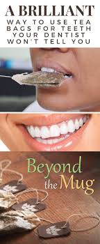 I followed the directions provided by dentist regarding salt water rinses etc. How To Stop Tooth Bleeding With Tea Bag Arxiusarquitectura