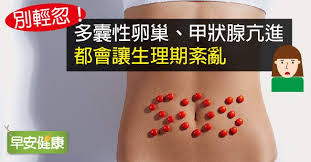 早安健康 孫于琛編譯 咦 這個月還沒來 剛邁入青春期的少女 經期不規律是常見的事 但已經過了青春期 生理期怎麼還常常鬧脾氣慢來呢 生理期紊亂的原因百百種 health girl power power