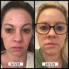 Has anyone had good results with this brand for their skin?