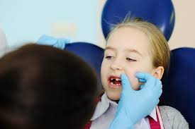 After all, your kids are incredibly active and might have suffered a few knocks and bruises on a practical note, keep an eye out for any redness, swelling, or your child complaining of pain in that area the following day. Should You Pull Out That Loose Tooth Superkids Dentistry Blog