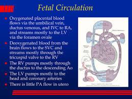 Image result for Delayed Transition from Fetal Circulation