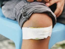 Image result for yellow scabs on the face in children