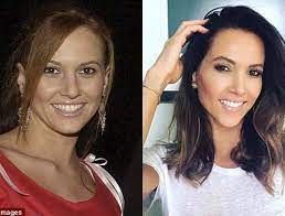 She is a former presenter for the weather channel in australia in 2009. The Surprising Diy Tricks Of Kyly Clarke Revealed How She Achieved Her Remarkable Appearance Without Stepping Foot In A Surgeon S Office Dr Haworth