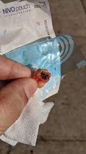 Aftercare following tooth extraction varies and entirely depends upon that the tooth that is extracted has deeper roots or not. Wisdom Tooth Was Pulled Very Rotten Hadtohurt