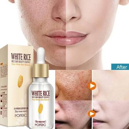 white rice whitening serum, Wholesale White Rice Whitening Pore Shrink Serum-15ml, Pore Shrink Serum, Serum, Beauty product, Skincare, wholesale skincare in bd, whitening pore shrink serum, Ladies serum, ladies beauty care