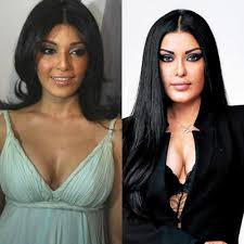 NEWS TRACK | Bollywood actress Koena Mitra opened up about the time she got a plastic surgery done and how the film fraternity had distanced themselves... | Instagram